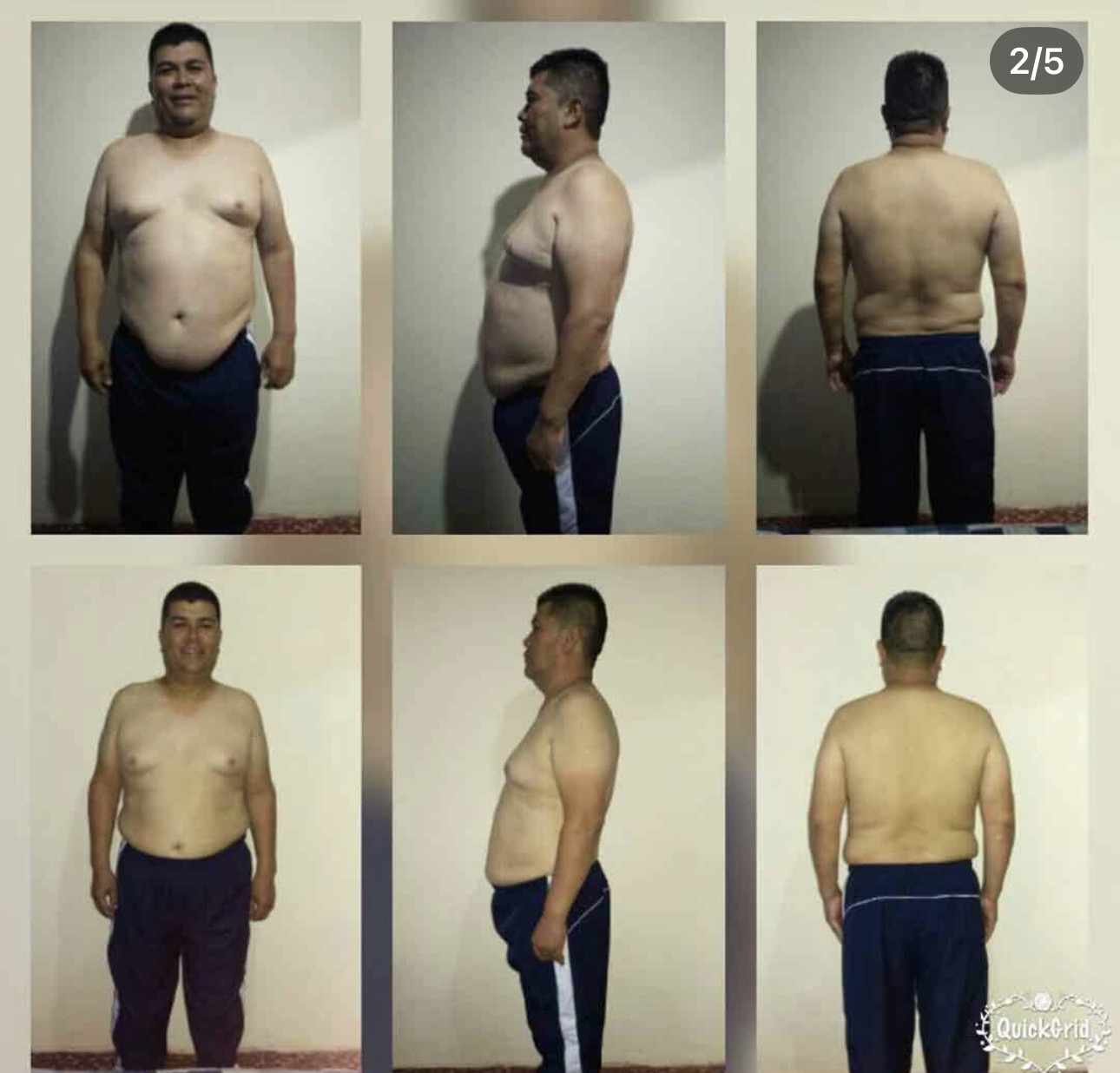 Resultado antes y después de un usuario